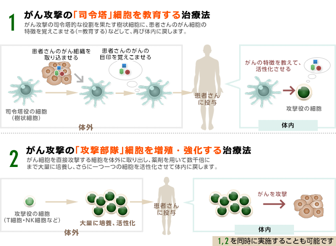 免疫細胞治療の種類