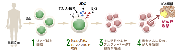 2DG･キラーT細胞療法とは
