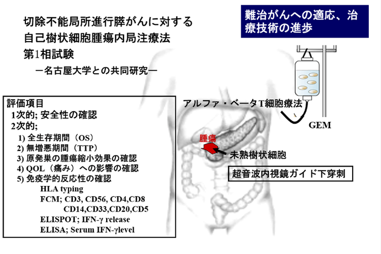 切除不能局所進行膵がんに対する自己樹状細胞腫瘍内局注療法第1相試験―名古屋大学との共同研究―