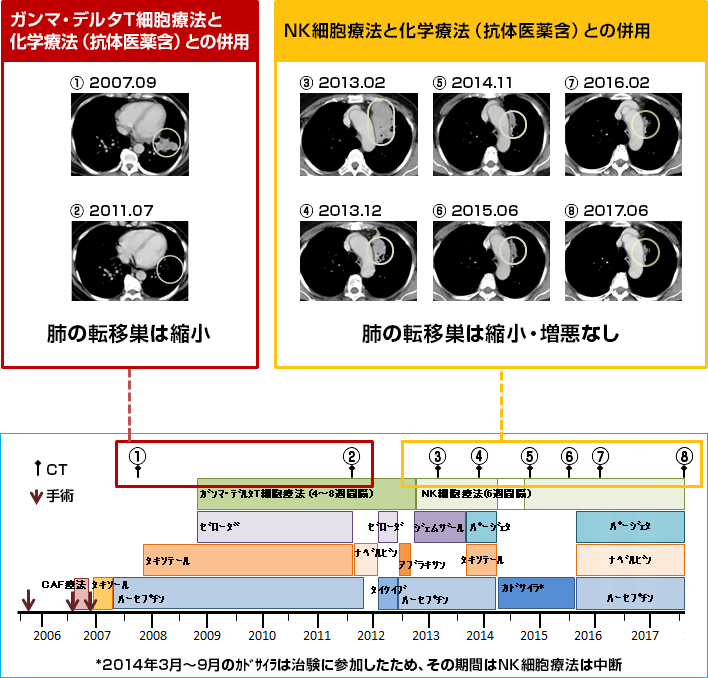 ガンマ・デルタT細胞療法と化学療法（抗体医薬含）との併用・NK細胞療法と化学療法（抗体医薬含）との併用