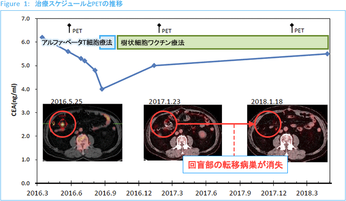 治療スケジュールとPETの経緯