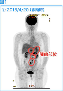図1 2015/4/20（診断時）
