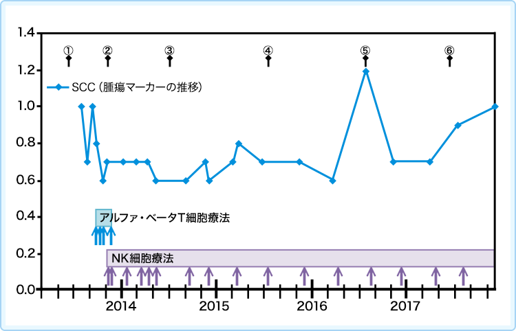 舌がんに対する免疫療法