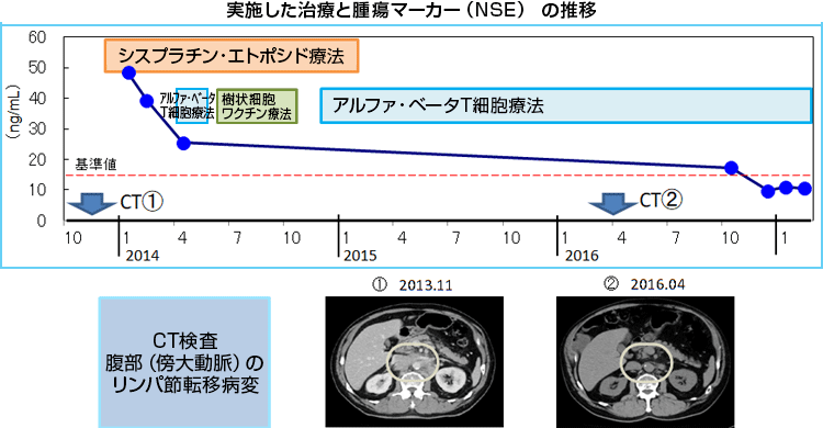 原発不明がんに対する免疫療法