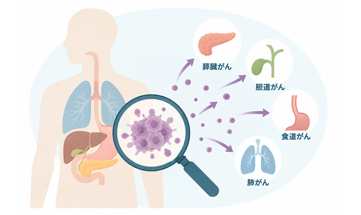 悪性度が高いがんとは? 特徴や種類、治療方法、分化度の基礎知識を解説