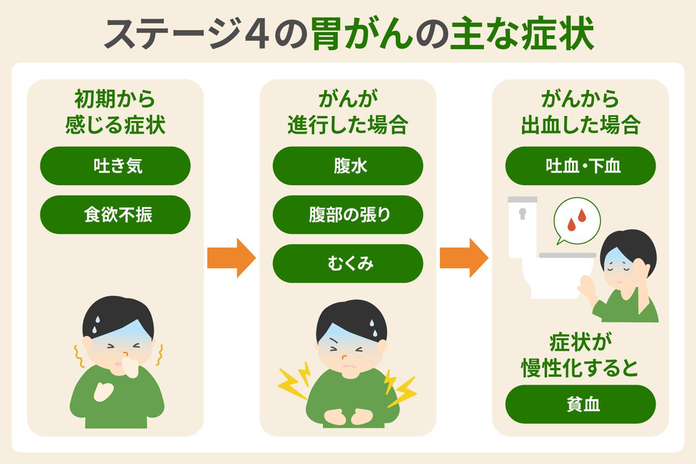 ステージ4の胃がんの主な症状