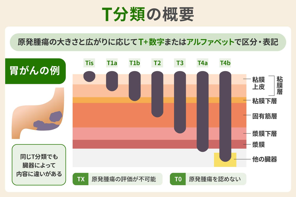 T分類の概要