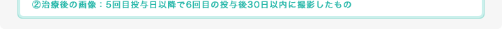 治療後の画像：5回目投与日以降で6回目の投与後30日以内に撮影したもの
