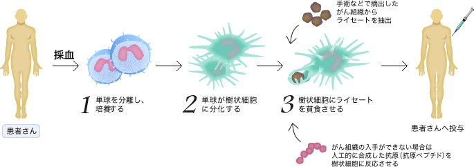 採血 -> 1.単球を分離し、培養する -> 2.単球が樹状細胞に分化する -> 3.樹状細胞にライセートを貧食させる(手術などで摘出したがん組織からライセートを抽出, がん組織の入手ができない場合は人工的に合成した抗原(抗原ペプチド)を樹状細胞に反応させる) -> 患者さんへ投与