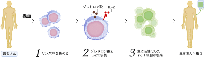 採血 -> 1.リンパ球を集める -> 2.ゾレドロン酸とIL-2で培養 -> 3.主に活性化したγδＴ細胞が増殖 -> 患者さんへ投与