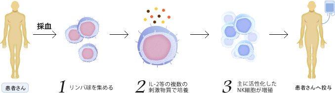 採血 -> 1.リンパ球を分離 2.活性化・培養（約2週間） 3.洗浄 -> 患者さんへ投与