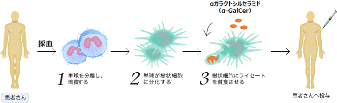 患者さん　採血→1.単球を分離し、培養する　2.単球が樹状細胞に分化する　aガラクトシルセラミド（α-GalCer）3.樹状細胞にライセートを貪食させる→患者さんへ投与