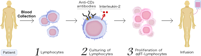 [Patient]Blood Collection -> 1.Lymphocytes -> 2.Culturing of Lymphocytes -> 3.Proliferation of αβT-Lymphocytes -> Infusion