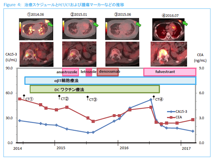 Figure4:治療スケジュールとPET/CTおよび腫瘍マーカーなどの推移