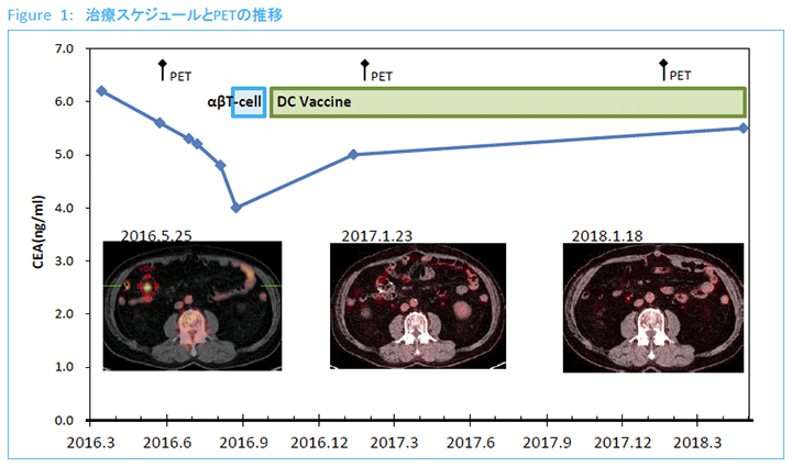 Figure1:治療スケジュールとPETの推移