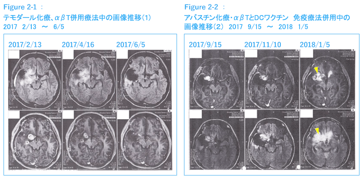 Figure2-1・Figure2-2