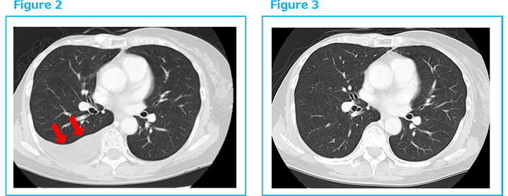 Figure2 Figure3