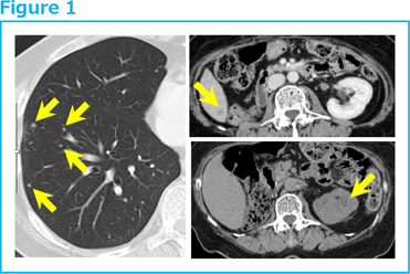 Figure1