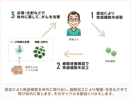 がん免疫療法（免疫細胞治療）のしくみ