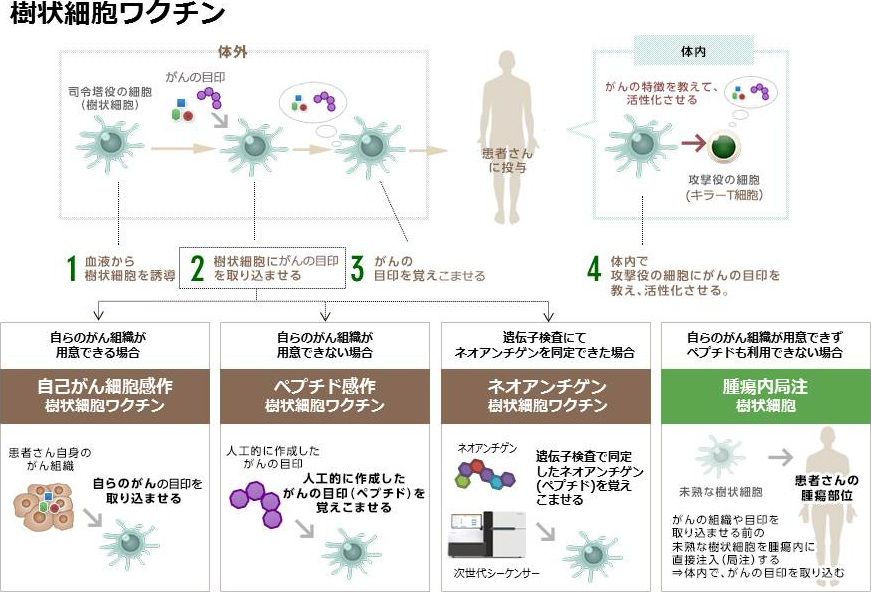 樹状細胞ワクチン