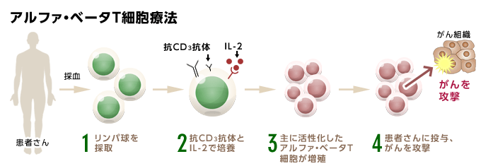 アルファ・ベータT細胞療法