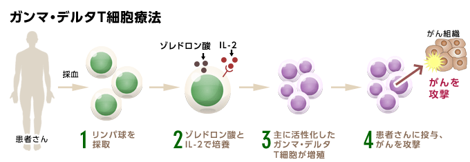 ガンマ・デルタT細胞療法