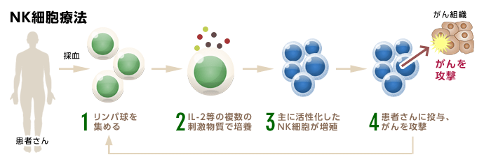 NK細胞療法