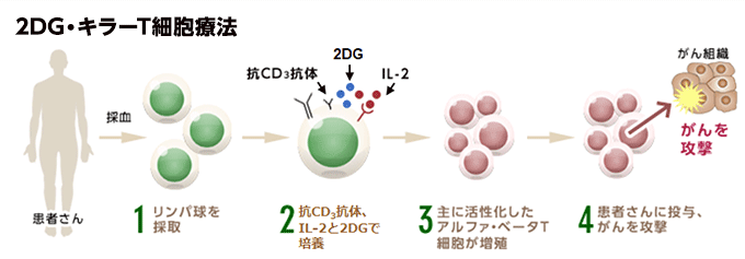 2DG･キラーT細胞療法