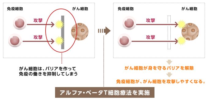 アルファ・ベータT細胞療法