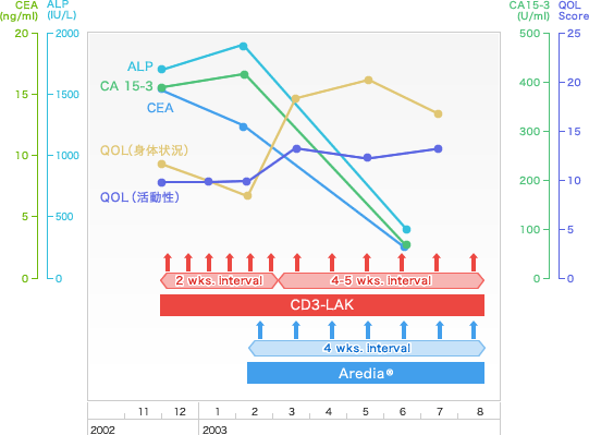 乳がんに対する免疫療法breast_cancer_c