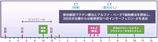 悪性黒色腫（メラノーマ）に対する免疫療法case17