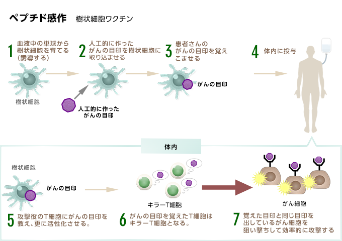 ペプチド感作樹状細胞ワクチン