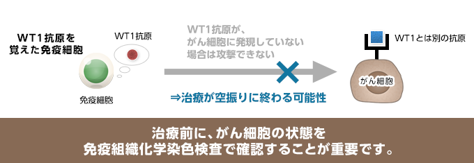 ＷＴ１分子が発現していないと判明した場合は、ＷＴ１による樹状細胞ワクチン治療の効果は望めません。