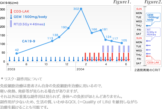 膵臓がんに対する免疫療法pancreatic_cancer1