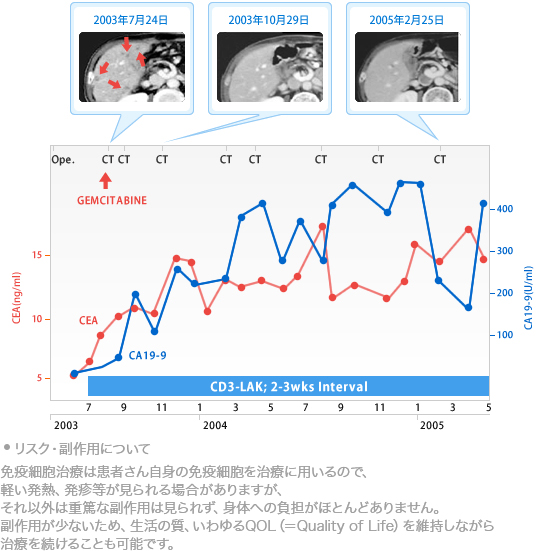 膵臓がんに対する免疫療法pancreatic_cancer3