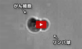 リンパ球（免疫細胞）ががん細胞を攻撃している顕微鏡映像【33秒】
