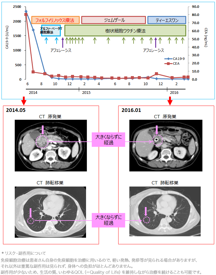 治療経過とマーカーの推移、CT画像の変化