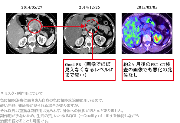 画像の変化